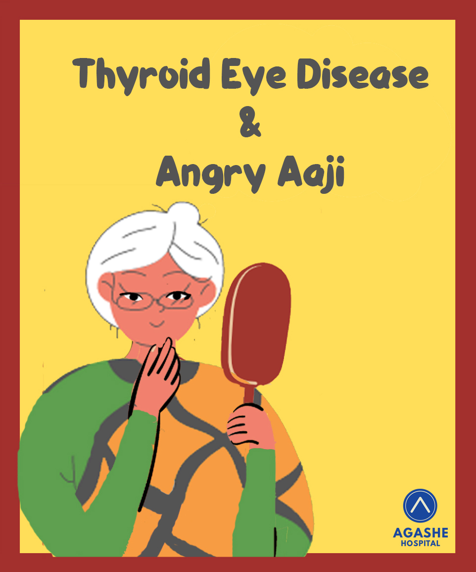 You are currently viewing Thyroid Eye Disease and an Angry Aaji
