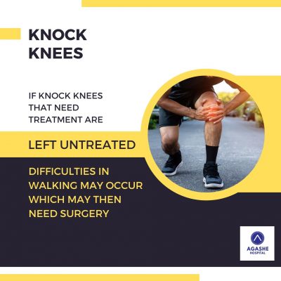 Knock