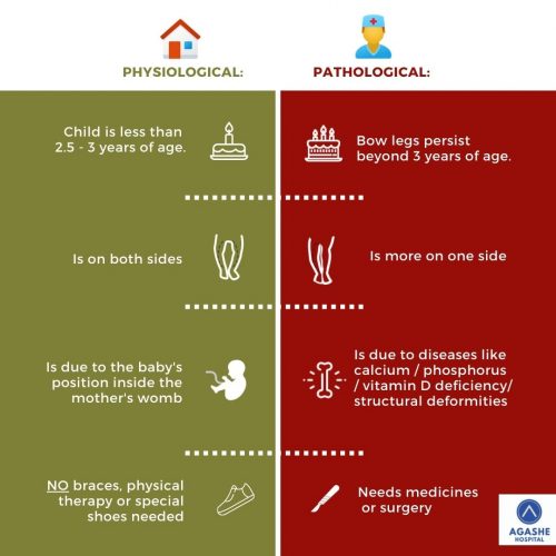 physiological vs pathological bow legs